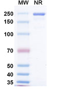 SDS-PAGE for Anti-Measles virus/MeV F/Fusion protein Antibody (mAb 77).