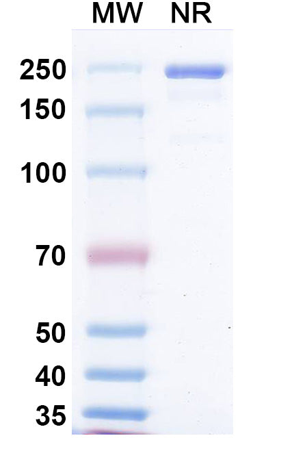 SDS-PAGE for Anti-Measles virus/MeV F/Fusion protein Antibody (mAb 77).