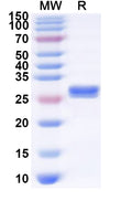 Recombinant HPV B19 VP2/Coat protein VP2 Protein, N-His
