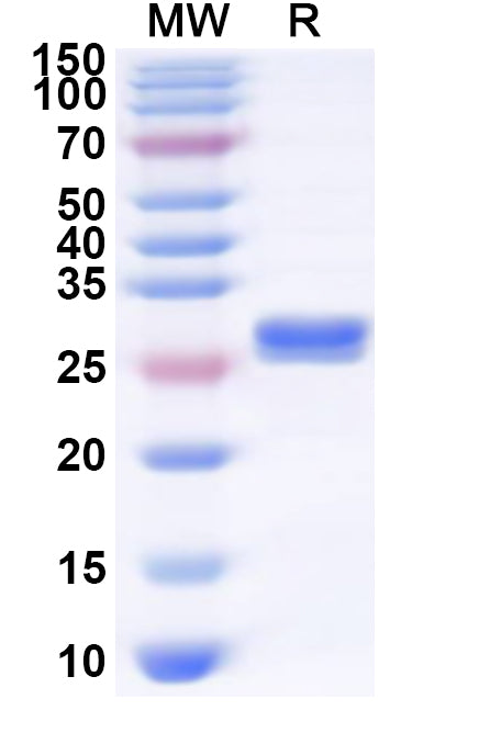 Recombinant HPV B19 VP2/Coat protein VP2 Protein, N-His