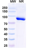 SDS-PAGE for Anti-HPV16 E6/Protein E6 Antibody (Nb9)
