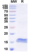 SDS-PAGE for Anti-HIV-1 Vif/SOR protein Nanobody (SAA1421)