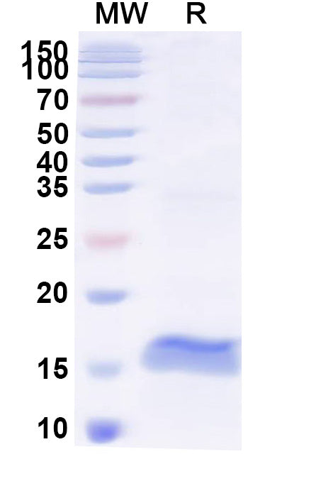 SDS-PAGE for Anti-HIV-1 Vif/SOR protein Nanobody (SAA1421)