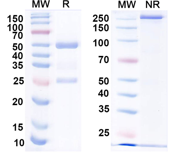 SDS-PAGE for Anti-HPV16 L1/Major capsid protein L1 Antibody (H16.1A).