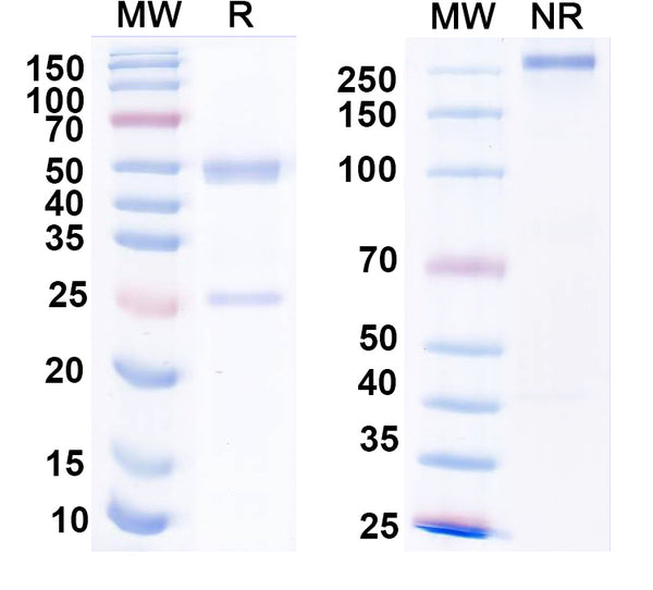 SDS-PAGE for Anti-HPV16 L1/Major capsid protein L1 Antibody (H263.A2).