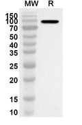 Western blot analysis was performed using anti-CSFV NS5B polyclonal antibody at 1ug/mL on recombinant CSFV NS5B (Catalog No. VK463012).