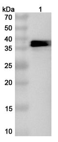 Western blot analysis was performed using anti-E1B polyclonal antibody at 1ug/mL on various samples.
Lane 1: recombinant HAdV-5 E1B-55K/E1B-495R (Catalog No: VK466022)