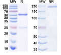 SDS-PAGE for Anti-SARS-CoV-2 S Protein antibody (1H7).