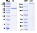 SDS-PAGE for Anti-SARS-CoV-2 S Protein antibody (1C2).