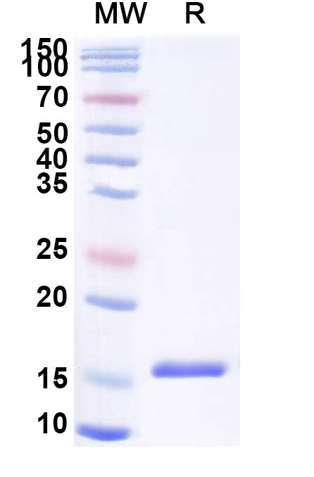 SDS-PAGE for Anti-SARS-CoV-2 S Protein Nanobody (SAA0893)