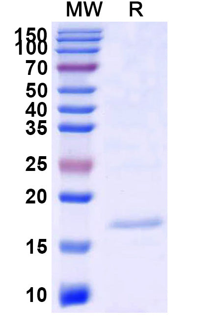 SDS-PAGE for Anti-SARS-CoV-2 S Protein Nanobody (SAA0909)