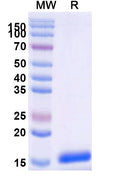 SDS-PAGE for Anti-SARS-CoV-2 S Protein Nanobody (SAA0910)