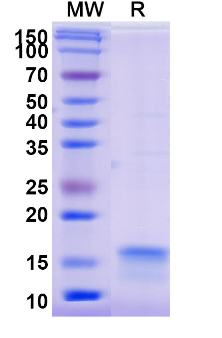 SDS-PAGE for Anti-SARS-CoV-2 S Protein Nanobody (SAA0913)