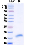 SDS-PAGE for Anti-SARS-CoV-2 S Protein Nanobody (SAA0914)