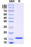 SDS-PAGE for Anti-SARS-CoV-2 S Protein Nanobody (SAA0915)