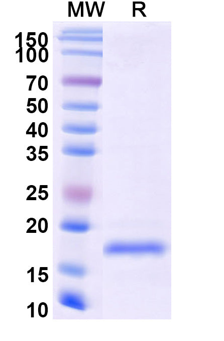 SDS-PAGE for Anti-SARS-CoV-2 S Protein Nanobody (SAA0916)