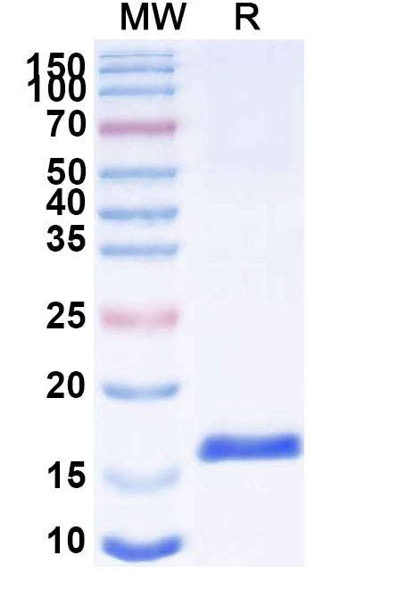 SDS-PAGE for Anti-SARS-CoV-2 S Protein Nanobody (SAA0942)