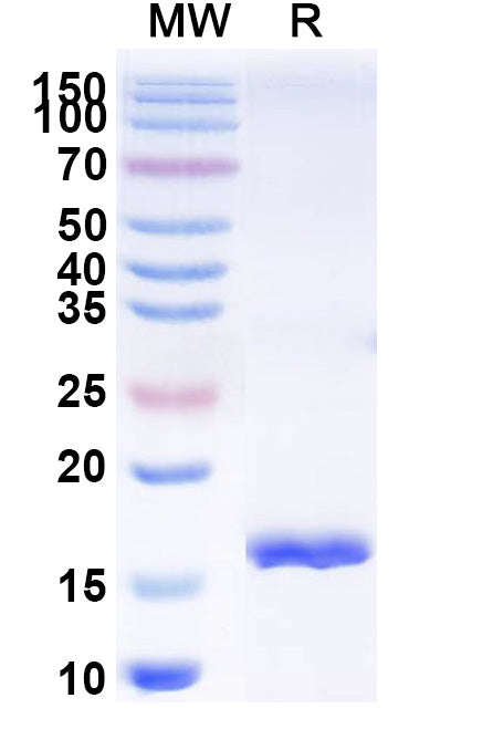 SDS-PAGE for Anti-SARS-CoV-2 S Protein Nanobody (SAA0944)