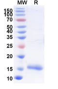 SDS-PAGE for Anti-SARS-CoV-2 S Protein Nanobody (SAA0946)
