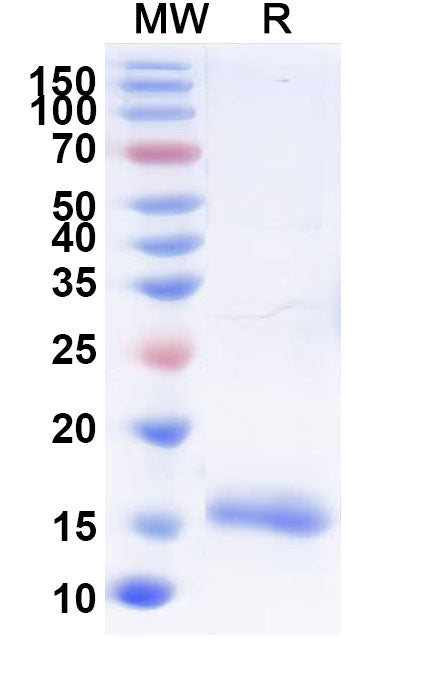 SDS-PAGE for Anti-SARS-CoV-2 S Protein Nanobody (SAA0946)