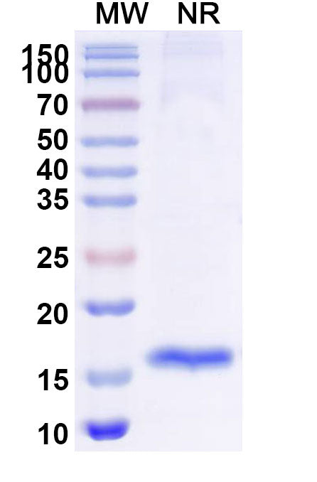 SDS-PAGE for Anti-SARS-CoV-2 S Protein Nanobody (SAA0948)