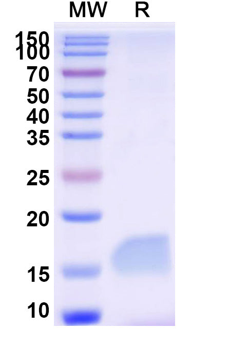 SDS-PAGE for Anti-SARS-CoV-2 S Protein Nanobody (SAA0949)