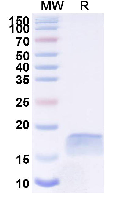 SDS-PAGE for Anti-SARS-CoV-2 S Protein Nanobody (SAA0952)