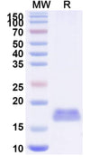 SDS-PAGE for Anti-SARS-CoV-2 S Protein Nanobody (SAA0956)