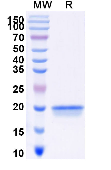 SDS-PAGE for Anti-SARS-CoV-2 S Protein Nanobody (SAA0957)