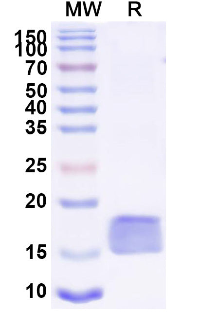 SDS-PAGE for Anti-SARS-CoV-2 S Protein Nanobody (SAA0967)