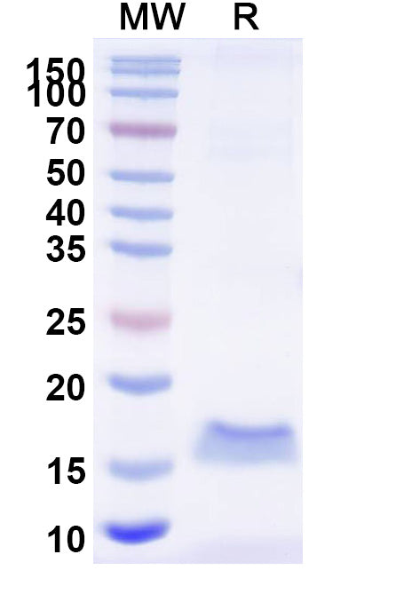SDS-PAGE for Anti-SARS-CoV-2 S Protein Nanobody (SAA0968)