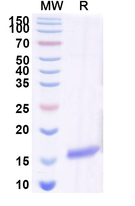 SDS-PAGE for Anti-SARS-CoV-2 S Protein Nanobody (SAA0969)