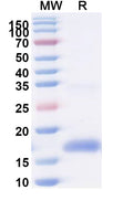 SDS-PAGE for Anti-SARS-CoV-2 S Protein Nanobody (SAA0996)