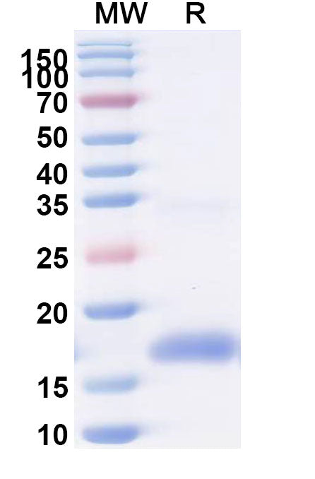 SDS-PAGE for Anti-SARS-CoV-2 S Protein Nanobody (SAA0996)