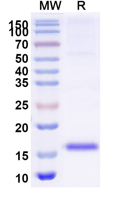 SDS-PAGE for Anti-SARS-CoV-2 S Protein Nanobody (SAA1027)
