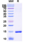 SDS-PAGE for Anti-SARS-CoV-2 S Protein Nanobody (SAA1048)