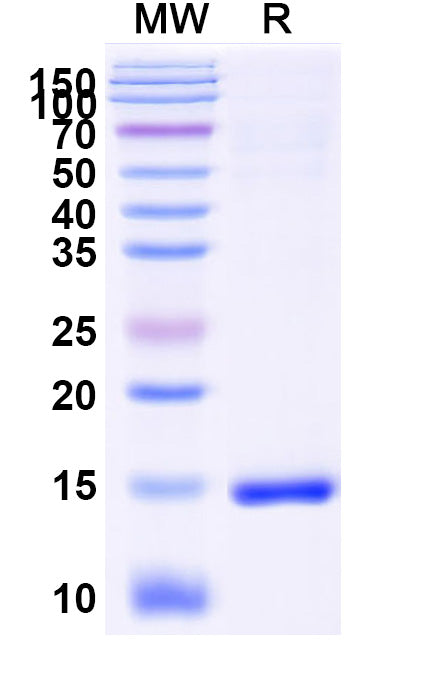 SDS-PAGE for Anti-SARS-CoV-2 S Protein Nanobody (SAA1048)
