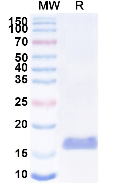 SDS-PAGE for Anti-SARS-CoV-2 S Protein Nanobody (SAA1057)