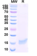 SDS-PAGE for Anti-SARS-CoV-2 S Protein Nanobody (SAA1058)