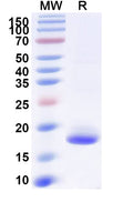 SDS-PAGE for Anti-SARS-CoV-2 S Protein Nanobody (SAA1062)