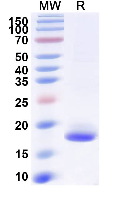 SDS-PAGE for Anti-SARS-CoV-2 S Protein Nanobody (SAA1062)