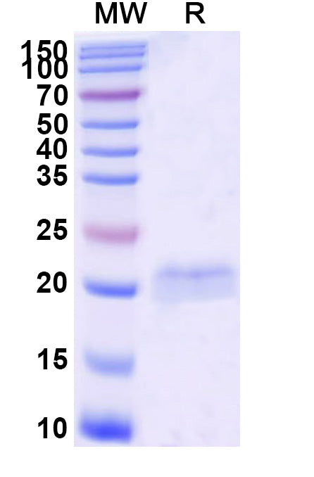 SDS-PAGE for Anti-SARS-CoV-2 S Protein Nanobody (SAA1063)