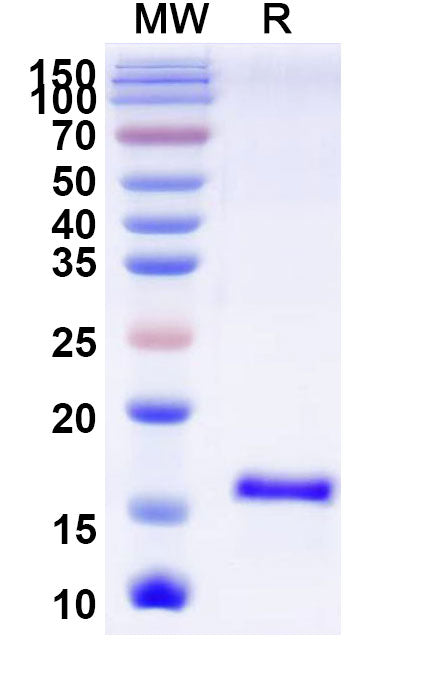 SDS-PAGE for Anti-SARS-CoV-2 S Protein Nanobody (SAA1068)