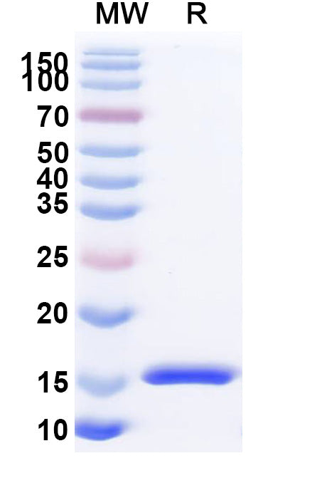 SDS-PAGE for Anti-SARS-CoV-2 S Protein Nanobody (SAA1076)