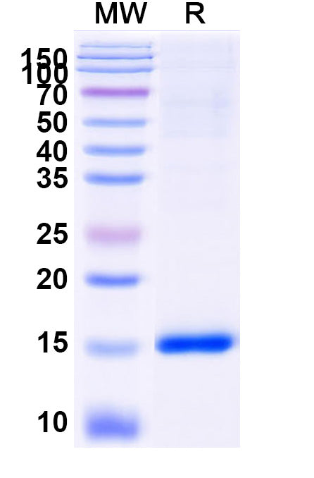 SDS-PAGE for Anti-SARS-CoV-2 S Protein Nanobody (SAA1082)