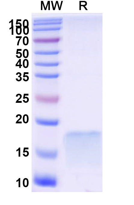 SDS-PAGE for Anti-SARS-CoV-2 S Protein Nanobody (SAA1092)