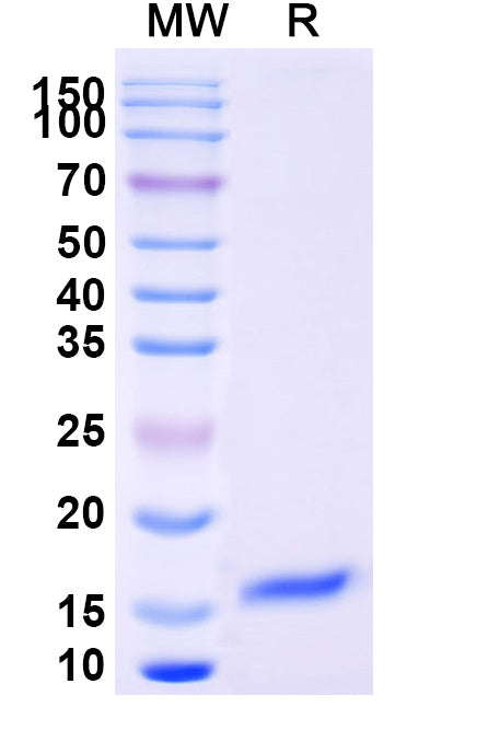 SDS-PAGE for Anti-SARS-CoV-2 S Protein Nanobody (SAA1094)