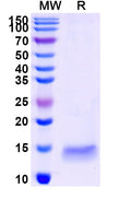 SDS-PAGE for Anti-SARS-CoV-2 S Protein Nanobody (SAA1096)