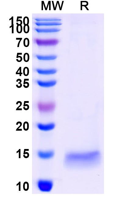 SDS-PAGE for Anti-SARS-CoV-2 S Protein Nanobody (SAA1096)