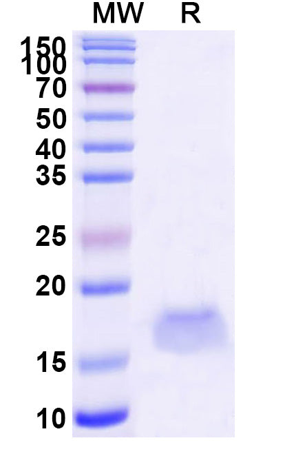 SDS-PAGE for Anti-SARS-CoV-2 S Protein Nanobody (SAA1102)